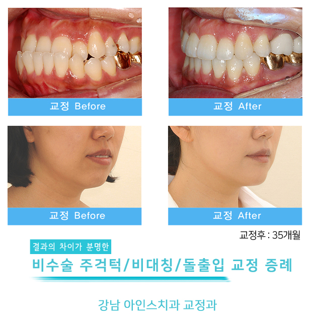 아인스치과의원 이미지
