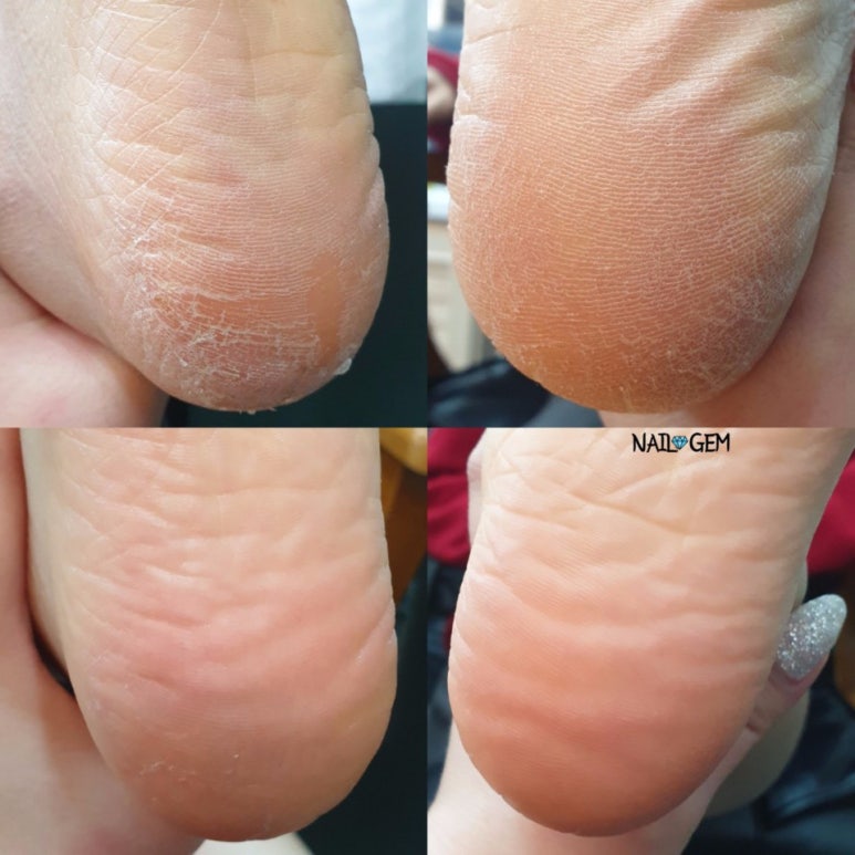 네일젬 이미지
