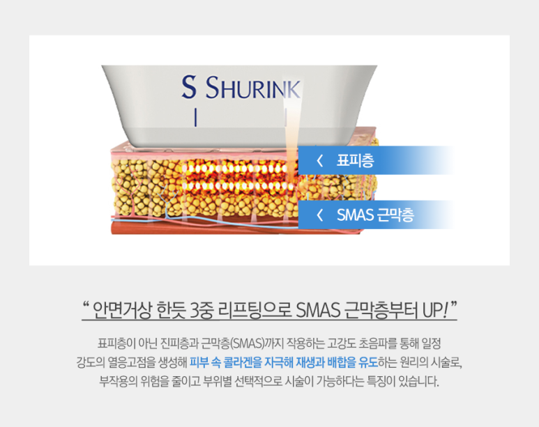 안티포커스 이미지