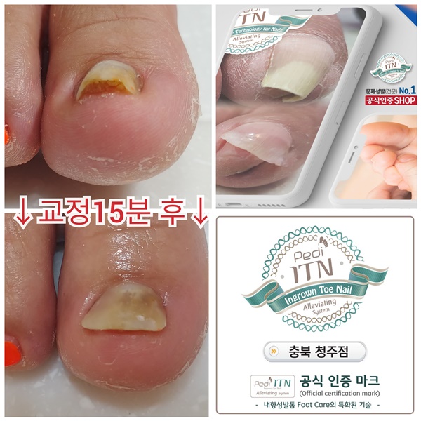 성실발관리샵 이미지