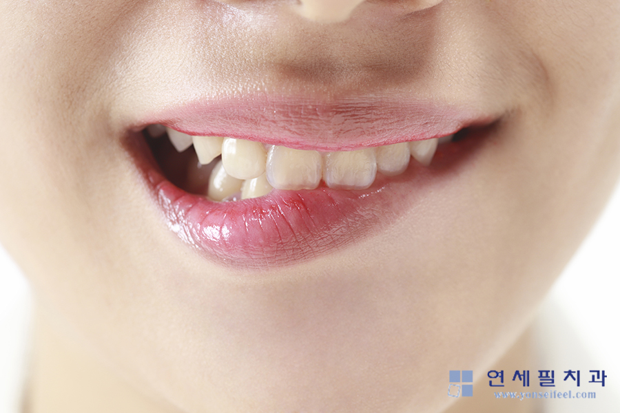 연세필치과교정과 이미지