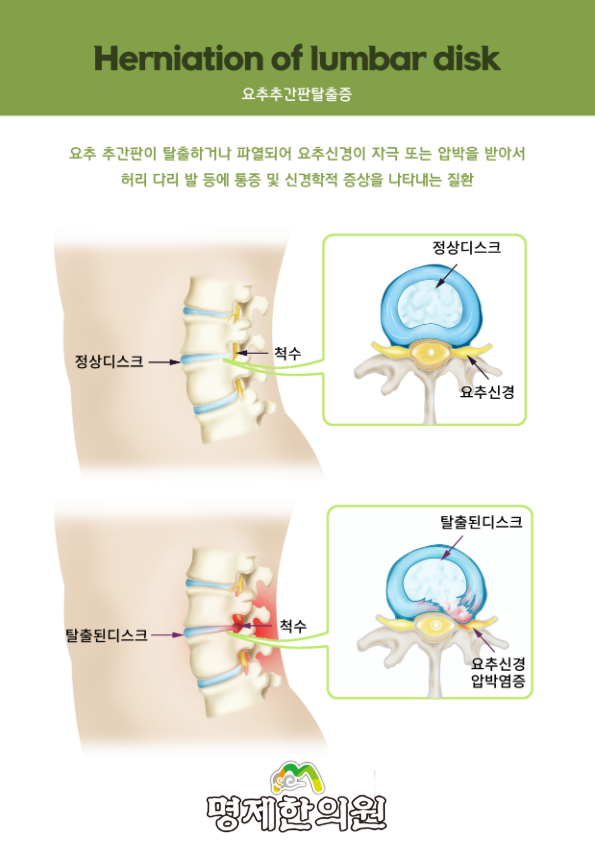 명제한의원 이미지