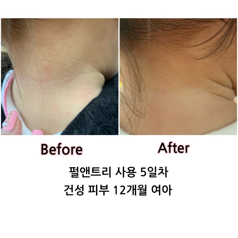이오스타 이미지