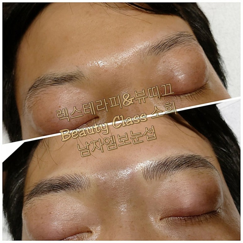 렉스테라피 이미지