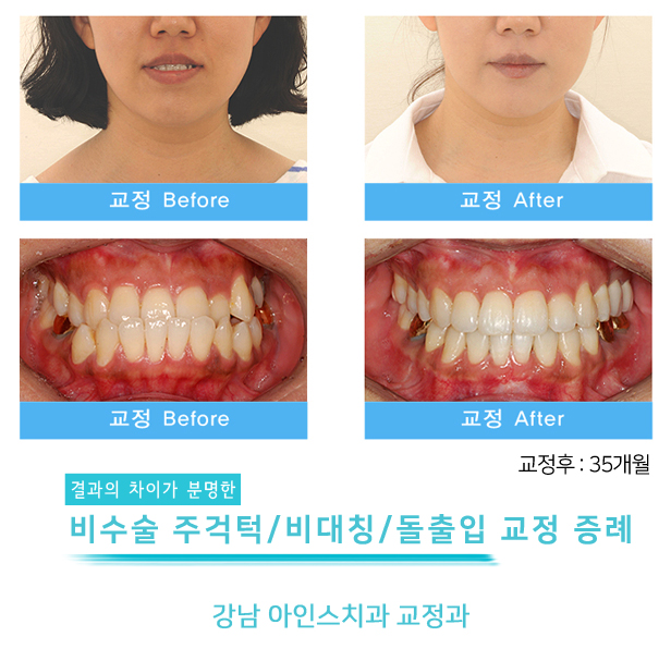 아인스치과의원 이미지