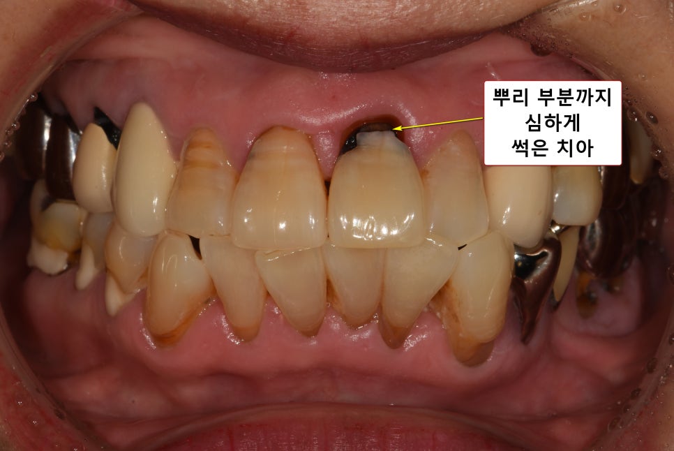 늘푸른연세치과 이미지