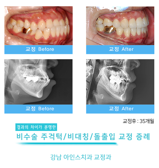 아인스치과의원 이미지