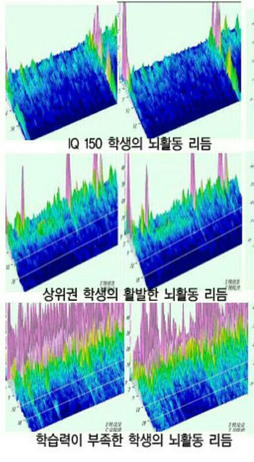 한국뉴로피드백연구소 이미지