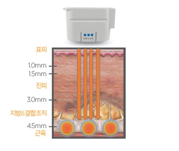 이은피부과 이미지
