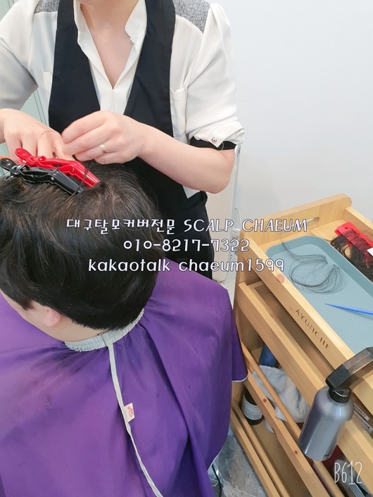 대구가발스칼프채움 이미지