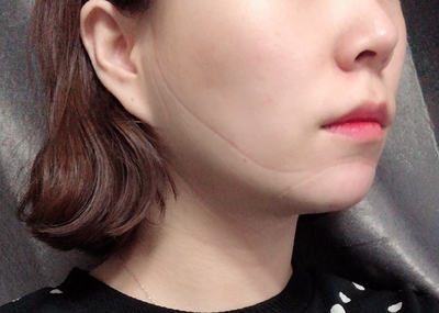 반디야식 이미지