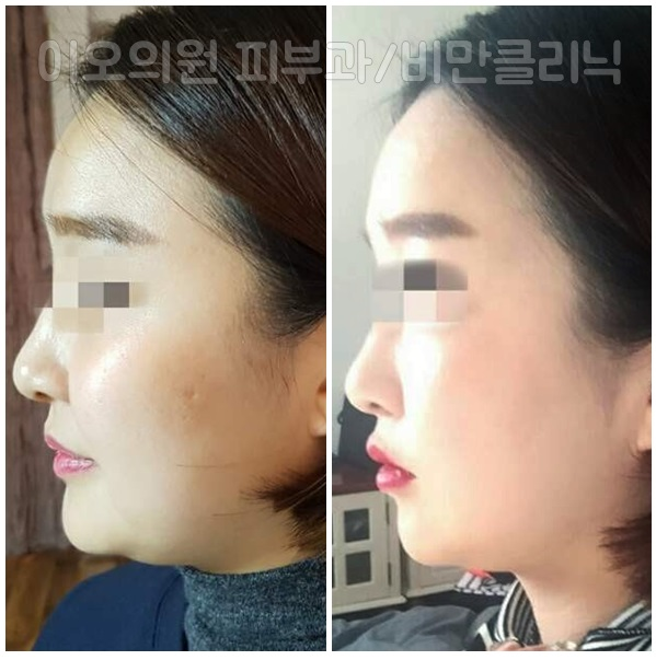이오V 이미지