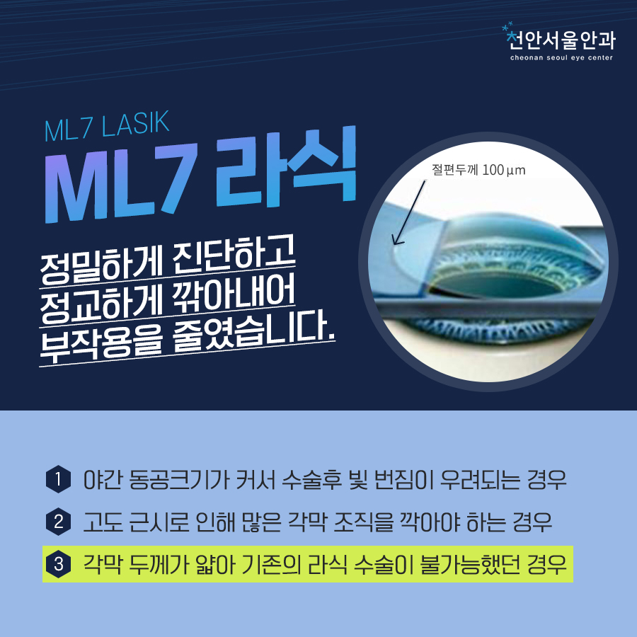 천안서울안과의원 이미지