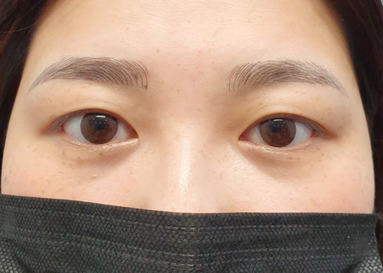 야시손톱 이미지
