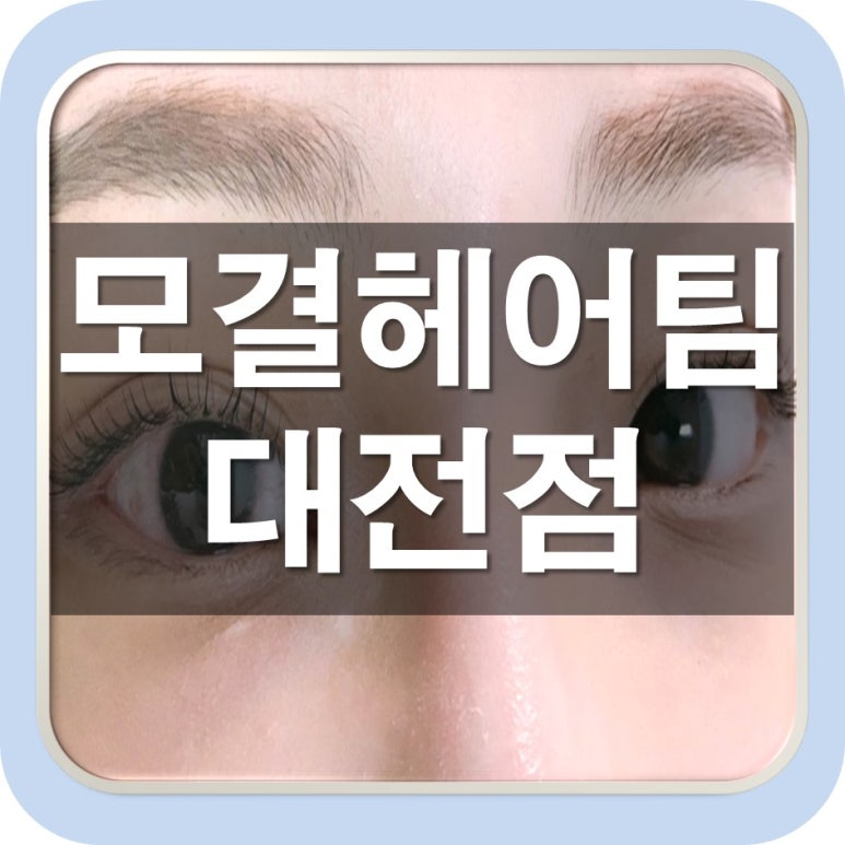 블레싱네일 이미지