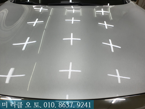 미라클덴트 이미지