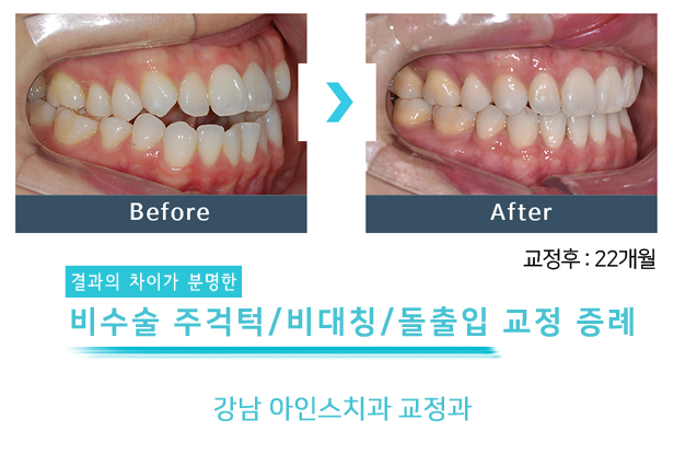 아인스치과의원 이미지