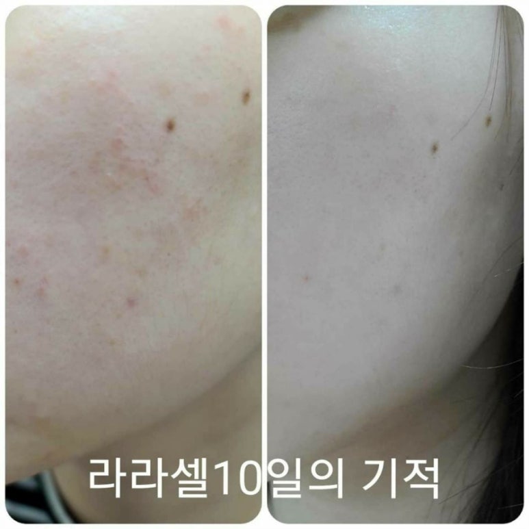 라셀 이미지