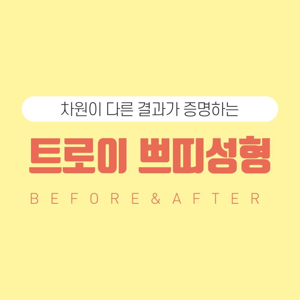 트로이성형외과 이미지