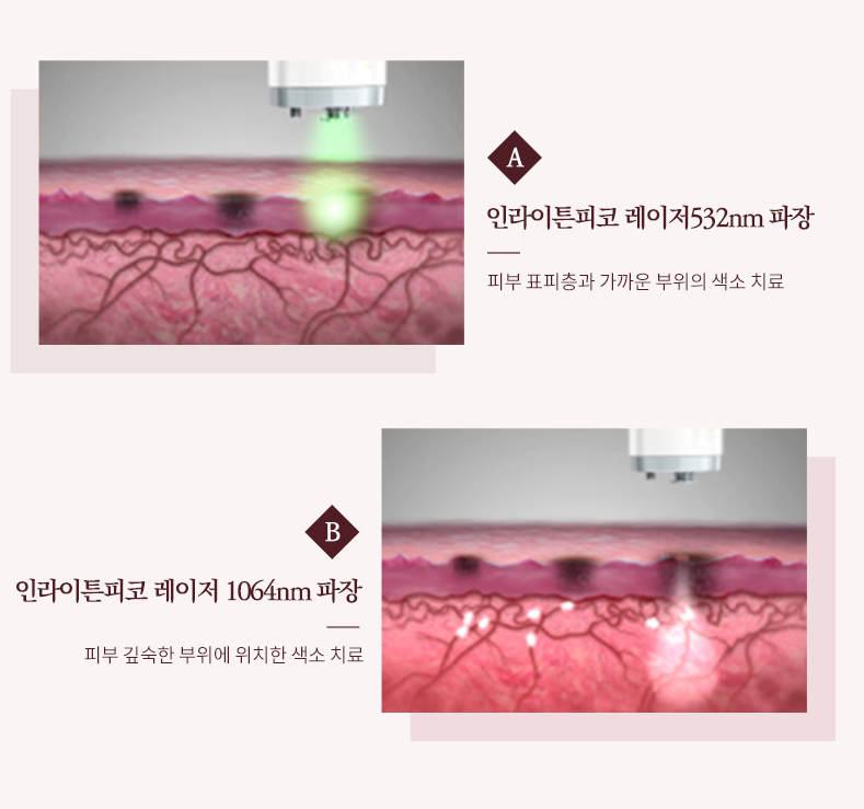 청담맑은피부과의원 이미지