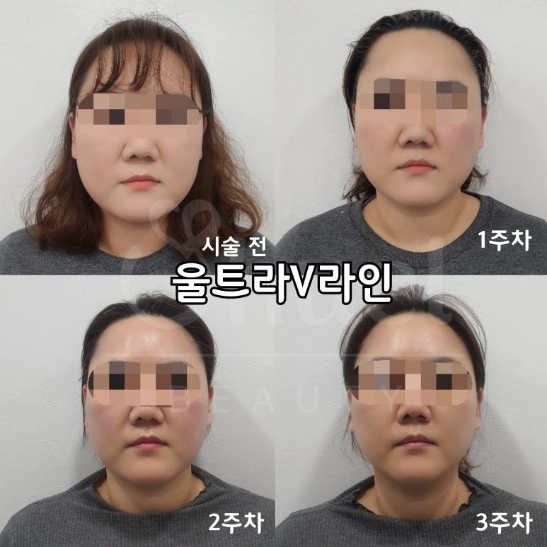브이라인샵 이미지