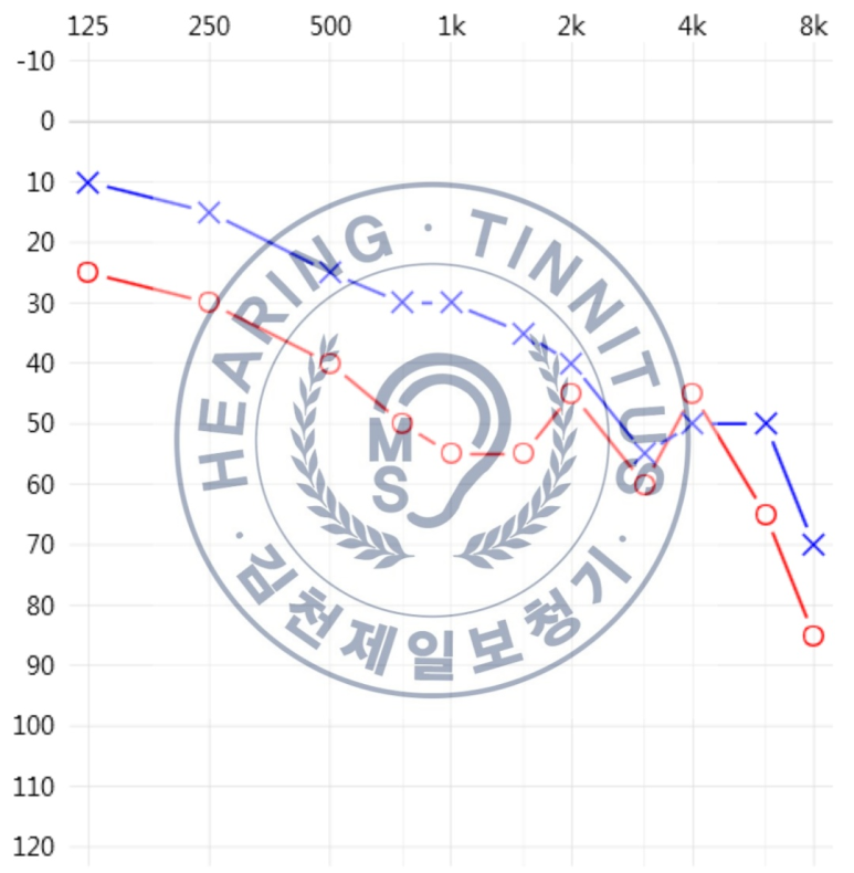 메디컬 보청기 이미지