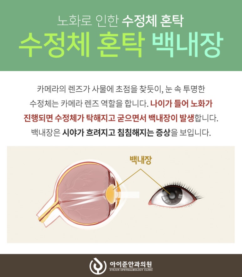 아이준안과 이미지