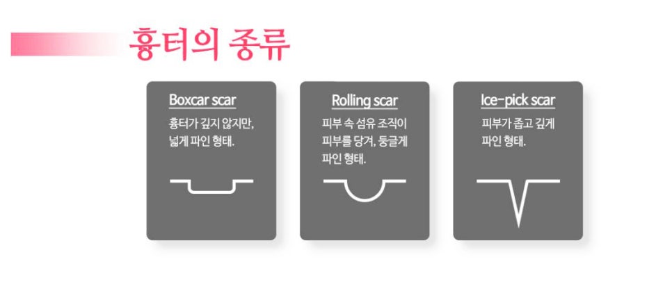 레가토 이미지