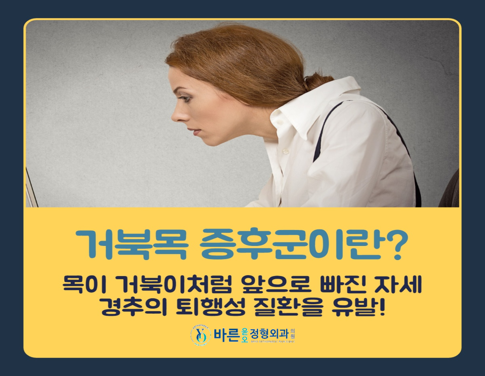 윤&오 이미지