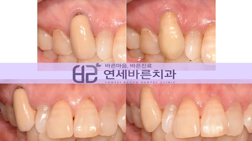 연세바른치과 이미지