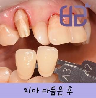 연세바른치과 이미지