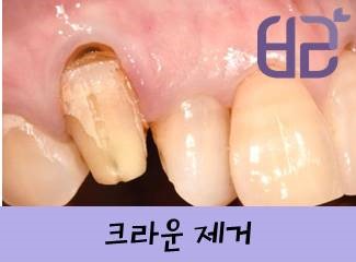 연세바른치과 이미지