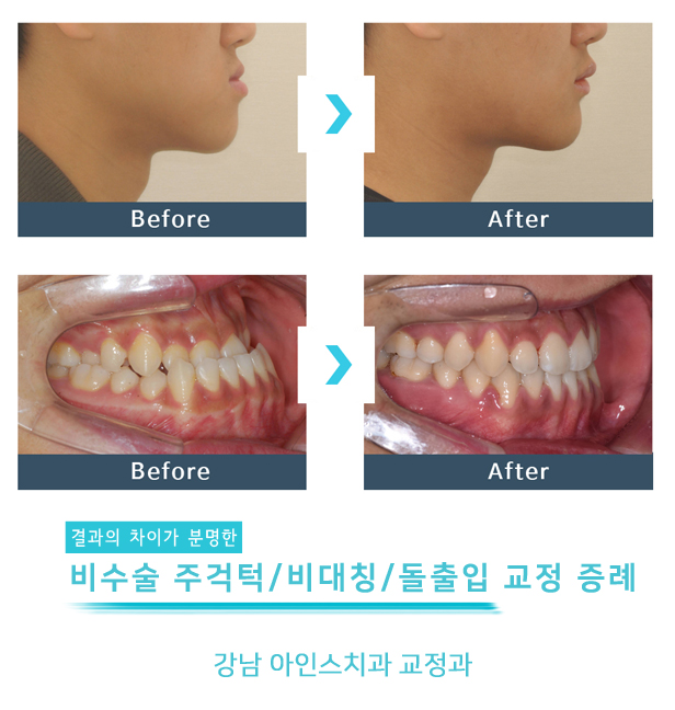 아인스치과의원 이미지