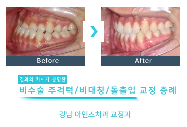 아인스치과의원 이미지