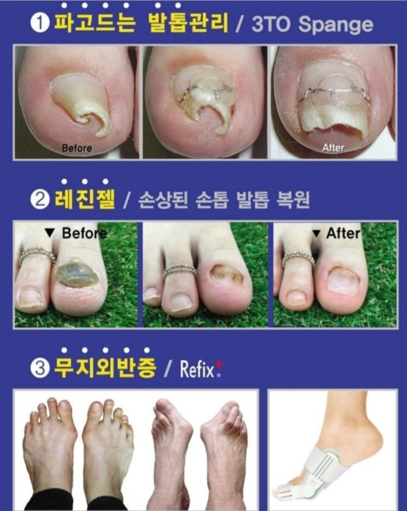 레푸스&양귀비네일 이미지