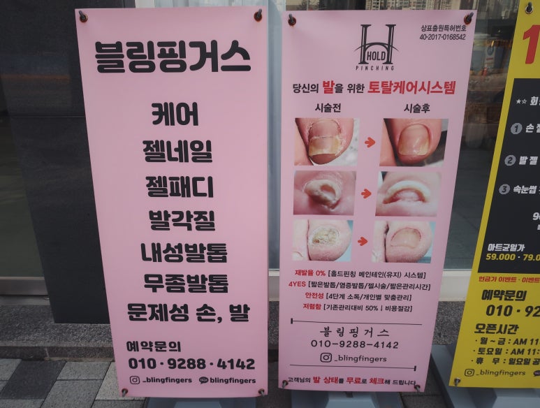 블링핑거스 이미지