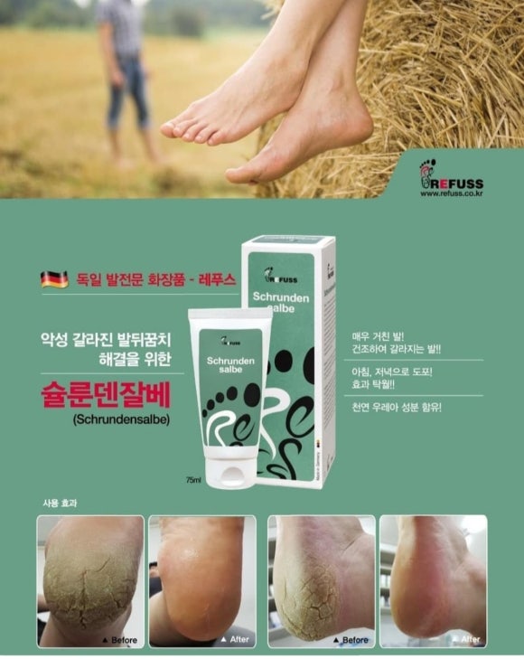 레푸스&양귀비네일 이미지