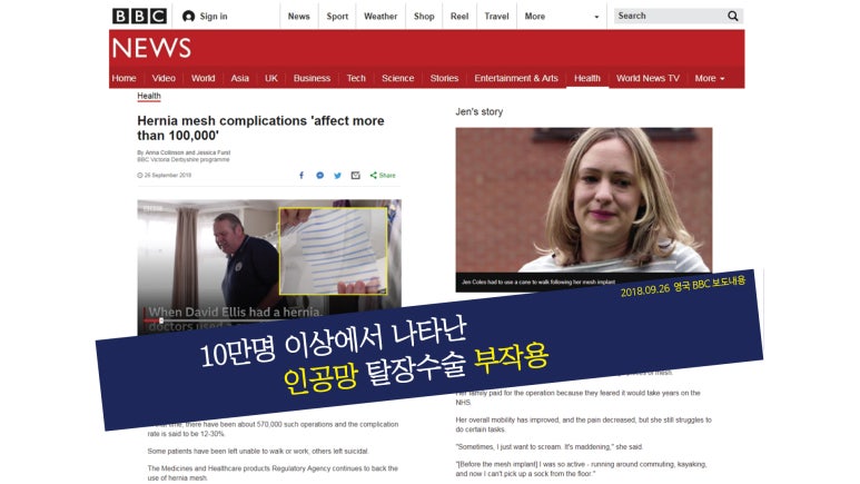 인지망 이미지