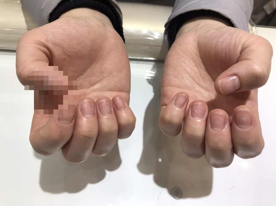 유얼스네일 이미지