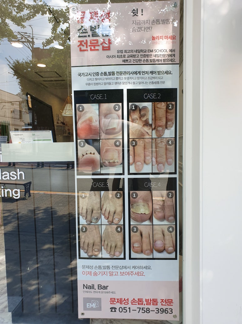 네일오다 이미지