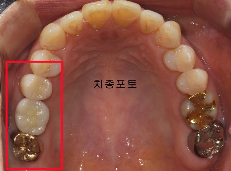 허브치과 이미지