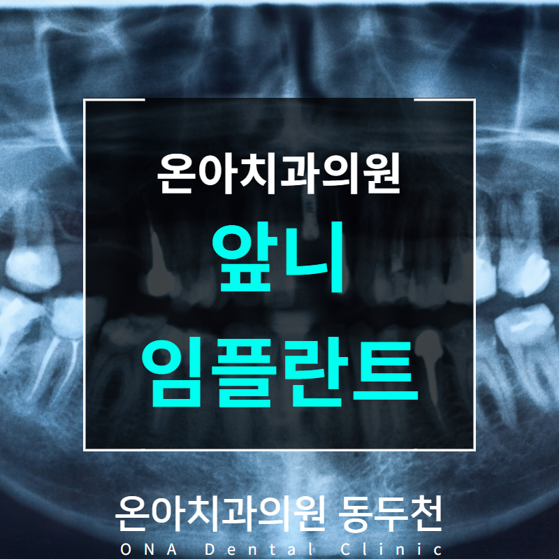 곤치과의원 이미지