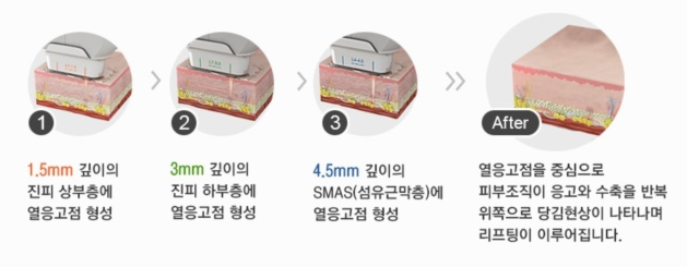 닥터쁘띠의원 이미지