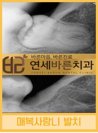 연세바른치과 이미지