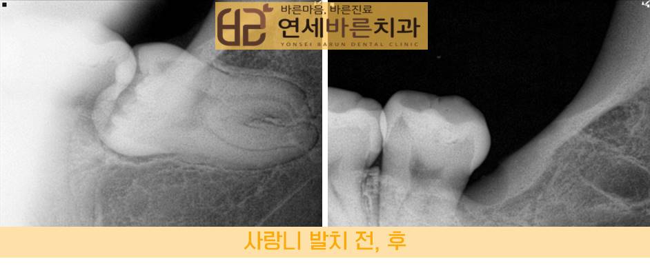 연세바른치과 이미지