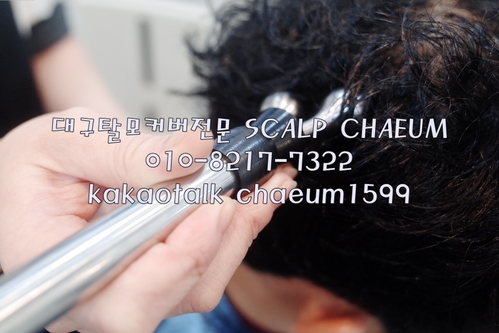 대구가발스칼프채움 이미지