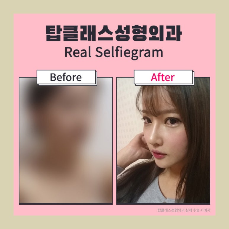 탑성형외과의원 이미지