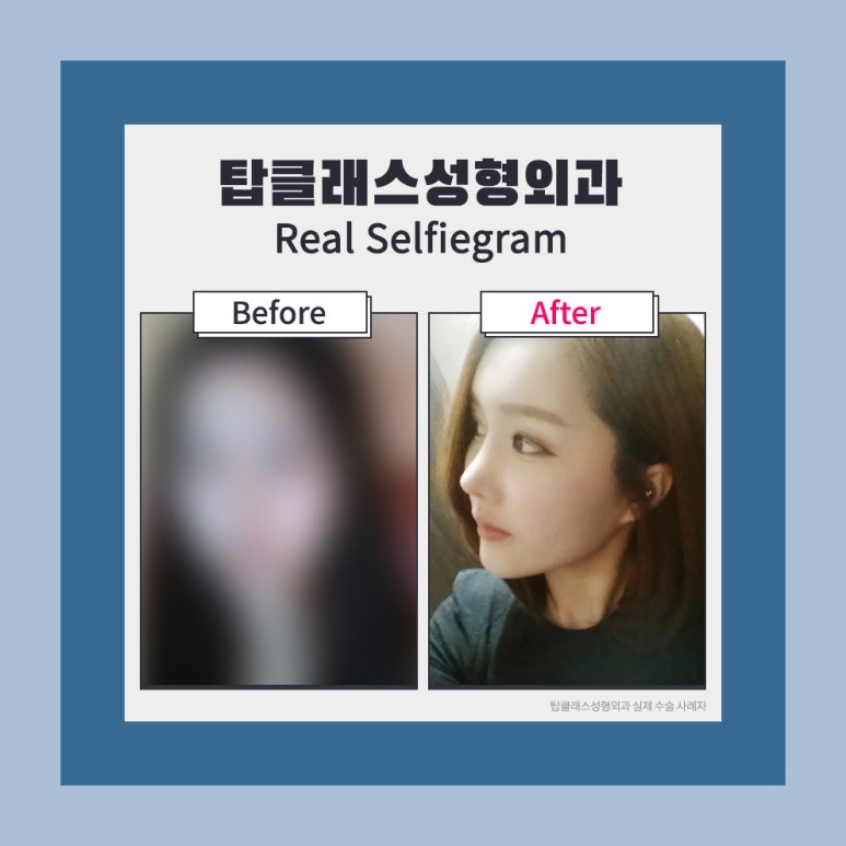 탑성형외과의원 이미지