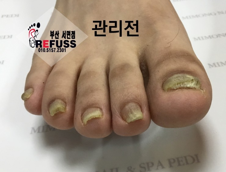 미몽 이미지