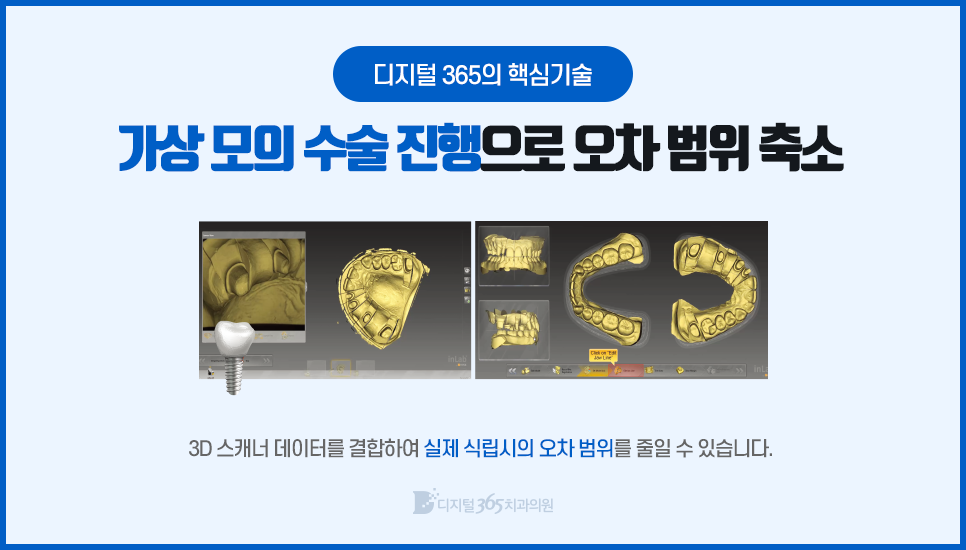 365디지털치과 이미지